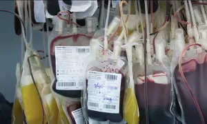 Tổn thương phổi - tai biến liên quan truyền máu